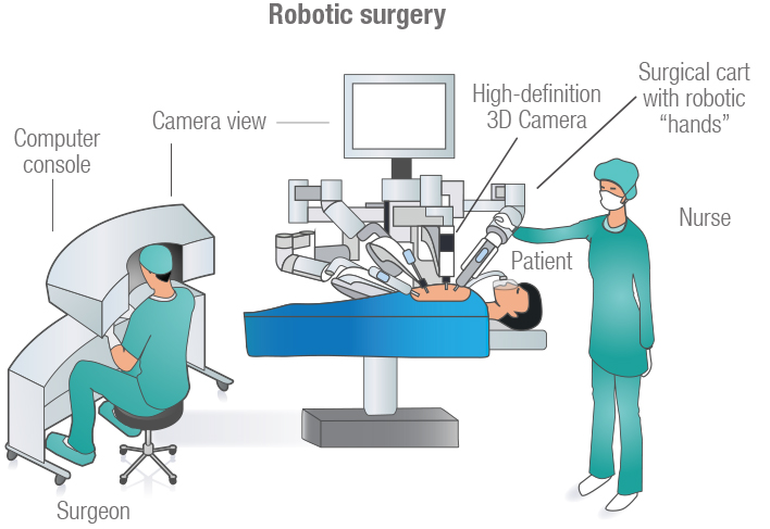 Robotic-Surgery-Illustration Diagram illustrating a robotic-assisted surgery on a patient, showcasing robotic arms and surgical tools in action