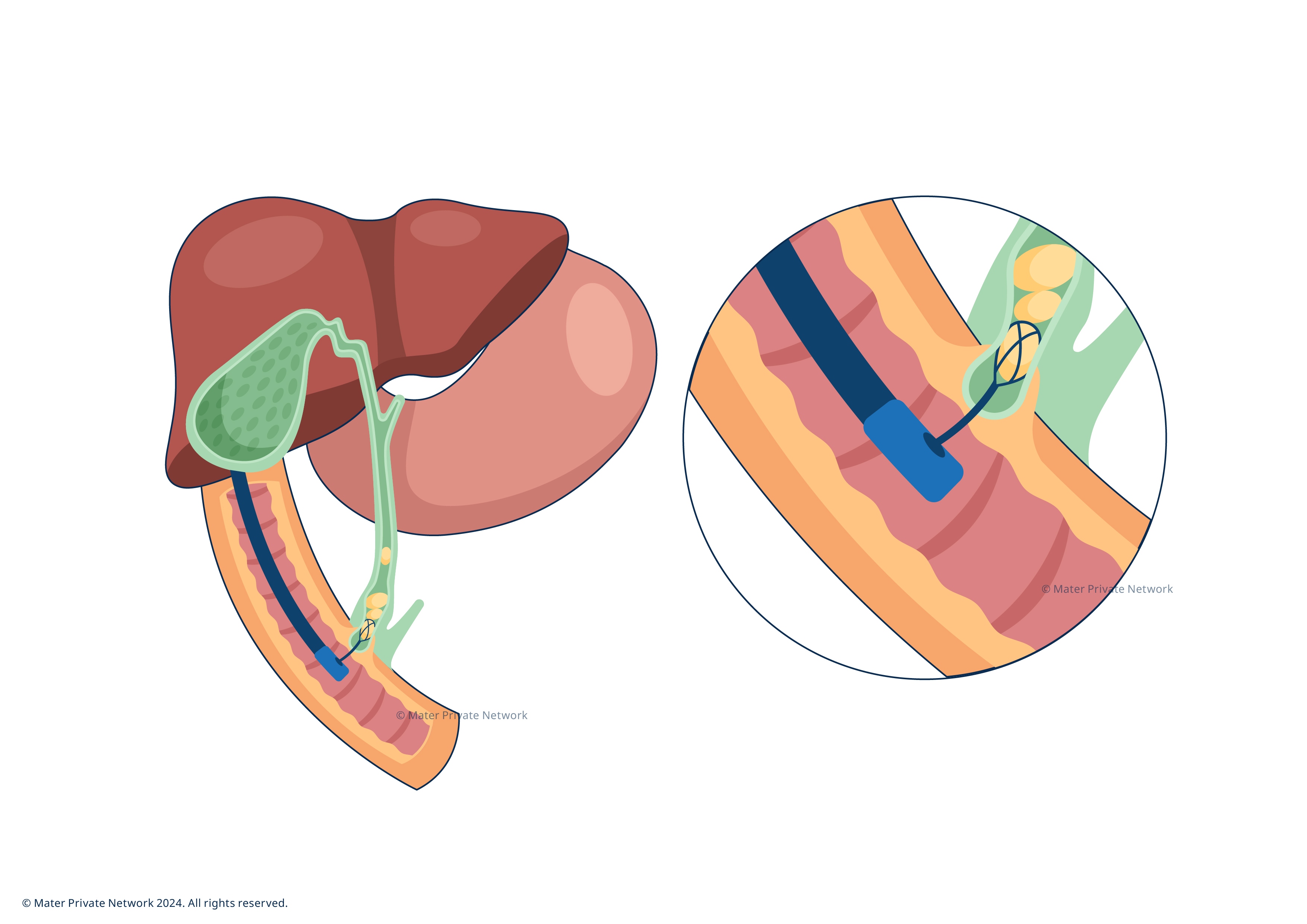 2078 ERCP images FA-02 2078 ERCP images FA-02