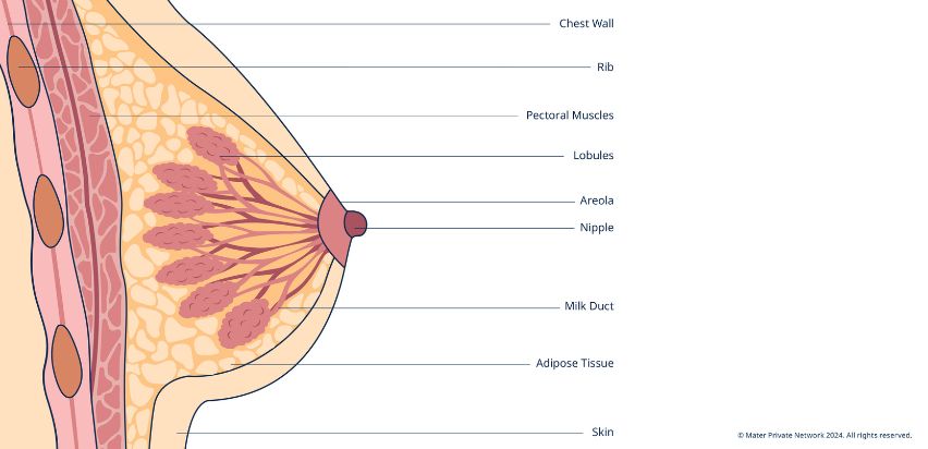breast cancer (article)